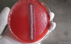 Haemophilus influenzae