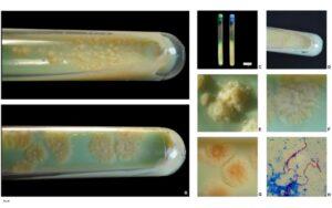 Morfología colonial bacteriana