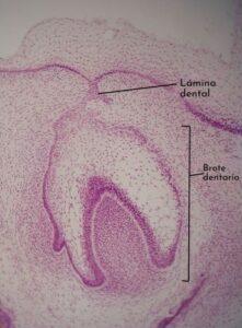 Odontogénesis