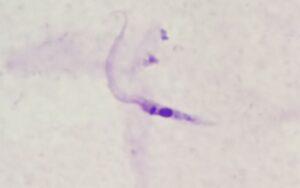 Trypanosoma cruzi