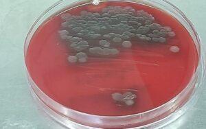 Pseudomonas aeruginosa