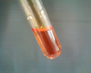 ¿Qué es la prueba del bromo?