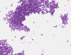 Corynebacterium glutamicum
